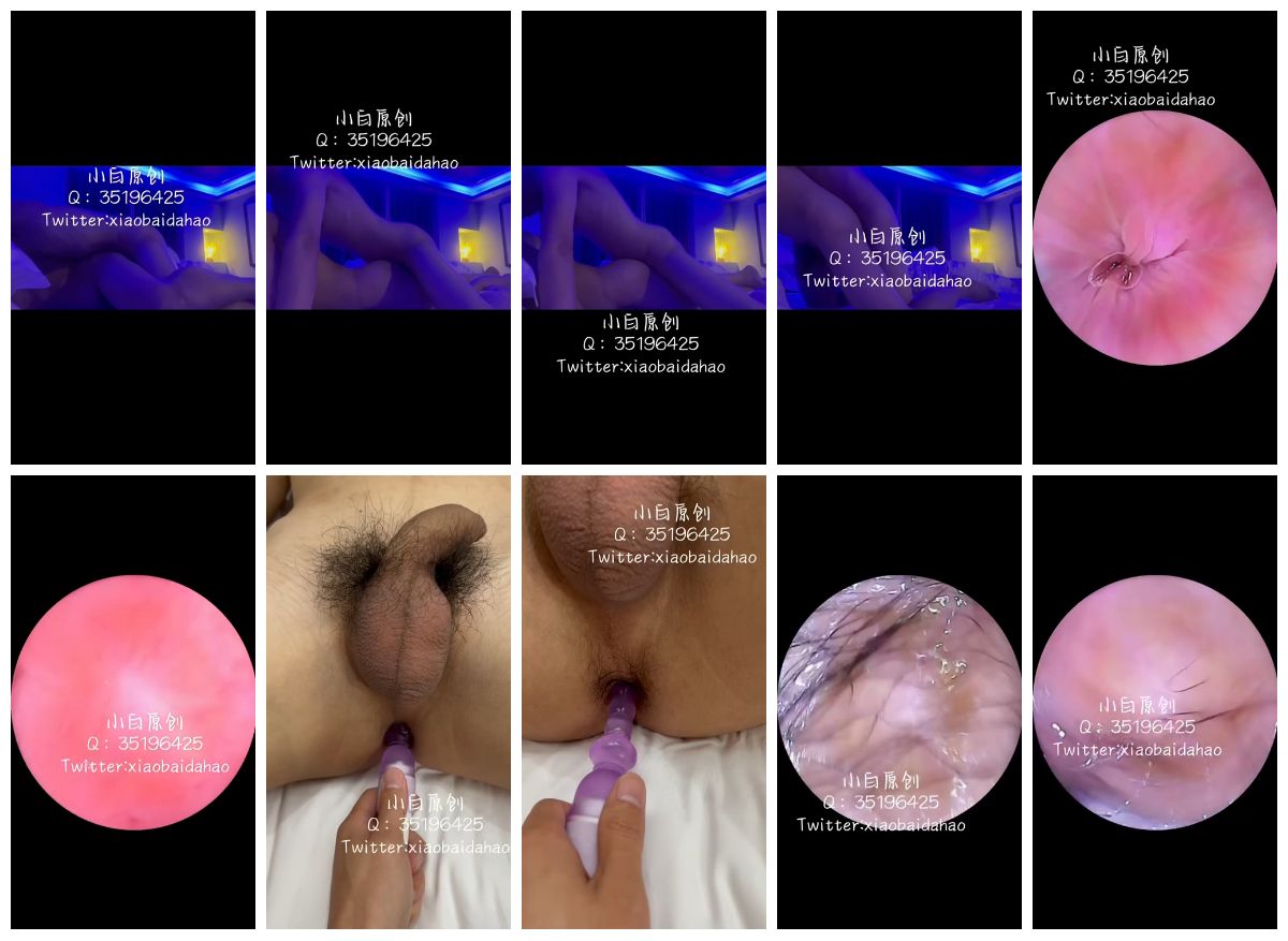 图片[1]-[小白原创] 内窥镜探索肌肉体育生神秘的直肠 [21:43] (720P)-Share1069 精品资源分享站